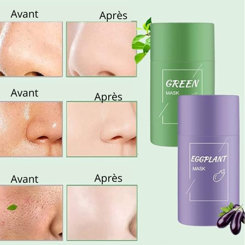 Masque Nettoyant en Profondeur  les Pores,les imperfections, les points noirs, les traces d'acné, le film de boue au Thé Vert